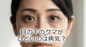 目の下のクマがひどいのは病気?腎臓や肝臓との関係と正しい治し方