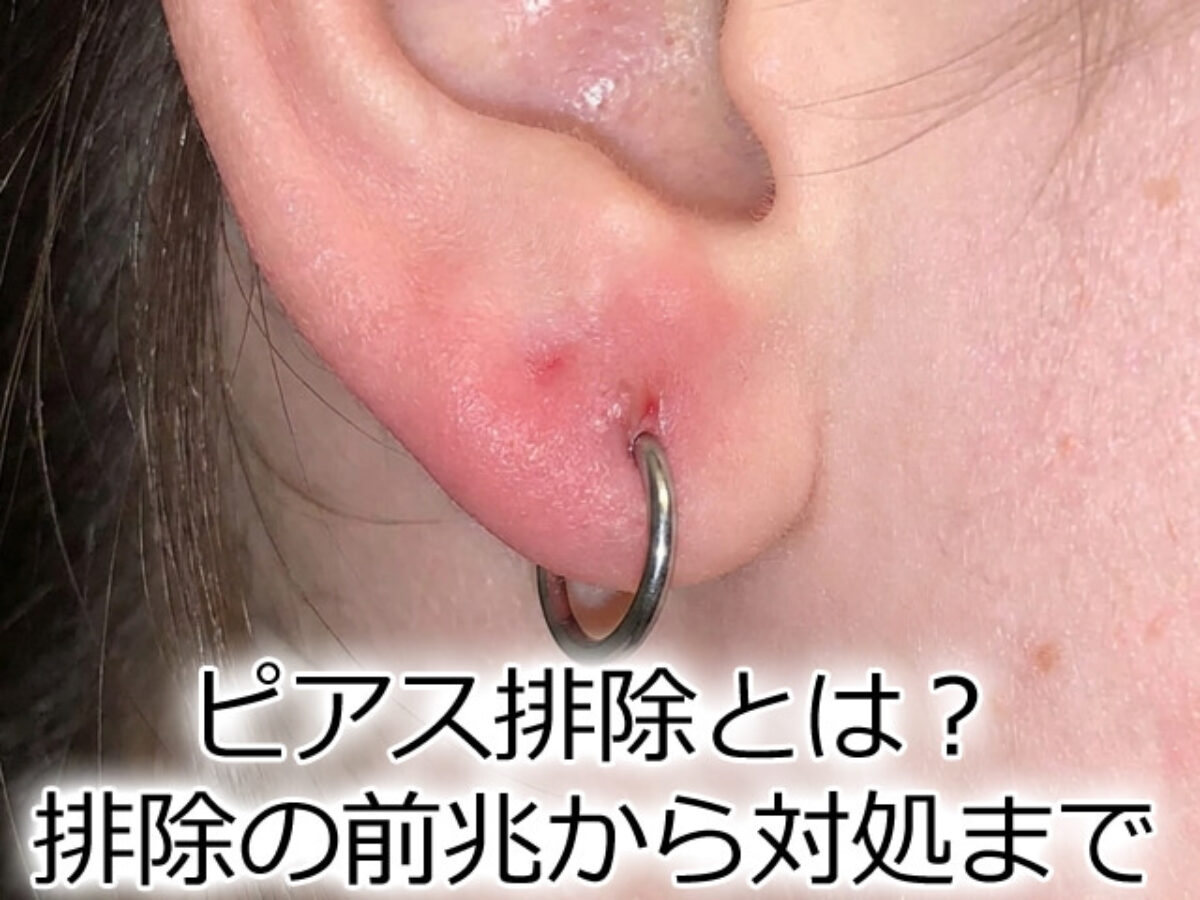 ピアス 排除 と は