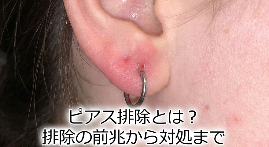 ピアス排除とは？排除の前兆から対処まで