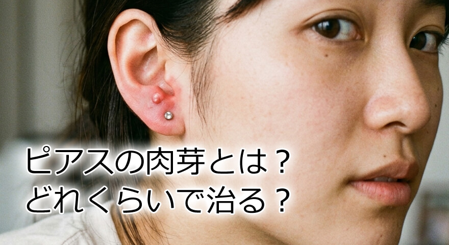 ピアスの肉芽とは？どれくらいで治る？放置してはいけない症状と対処法